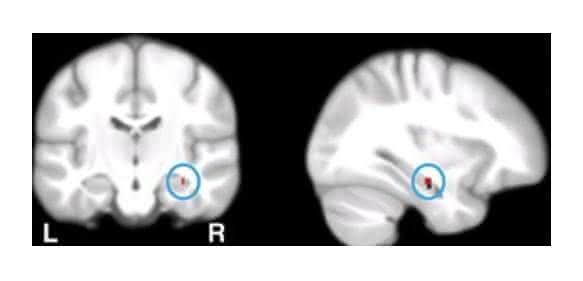 Hippocampus: Hippocampus: Wissenschaftler der Universität Basel haben nachgewiesen, dass Gedächtnisfunktionen von Calcium-Genen abhängen
