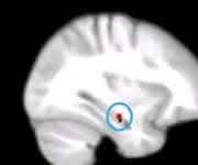 Hippocampus: Hippocampus: Wissenschaftler der Universität Basel haben nachgewiesen, dass Gedächtnisfunktionen von Calcium-Genen abhängen