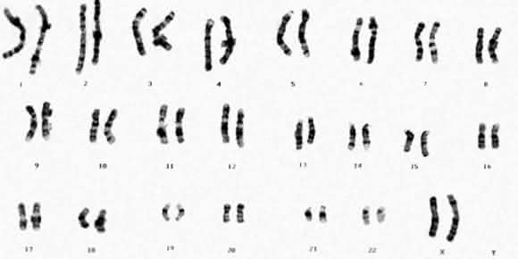 Chromosomensatz