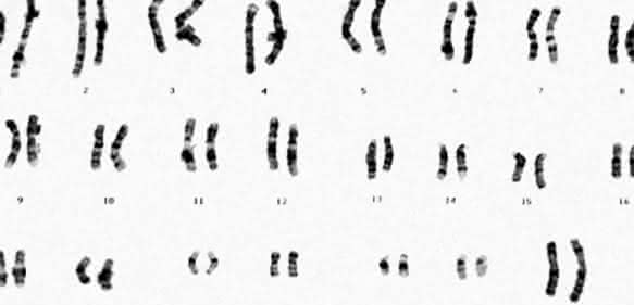 Chromosomensatz