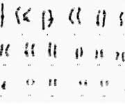 Chromosomensatz
