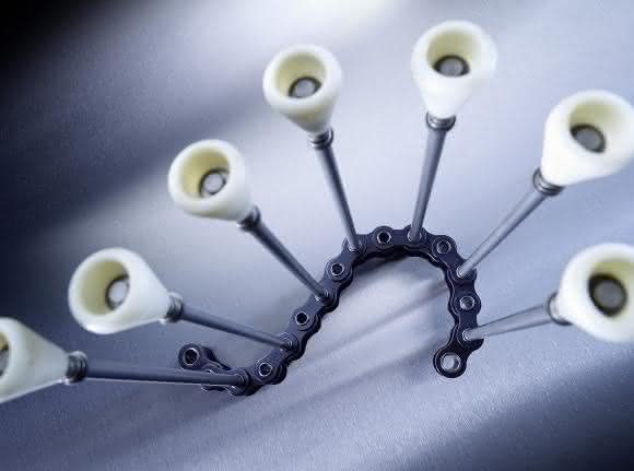 Spezial-Förderketten: Pin Oven Chains von iwis Spezial-Förderketten: Pin Oven Chains von iwis