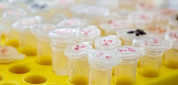 DNA-Proben DNA-Proben