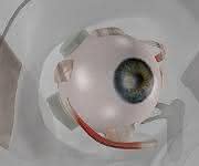 Auge mit Implantat