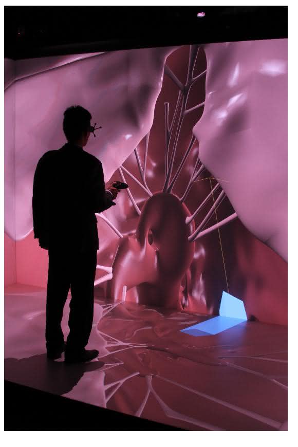 „Living Heart“-Modell Das „Living Heart“-Modell von Dassault Systèmes