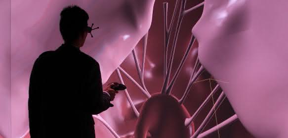 Das „Living Heart“-Modell von  Dassault Systèmes