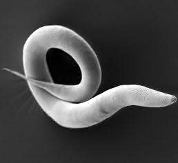 Caenorhabditis elegans
