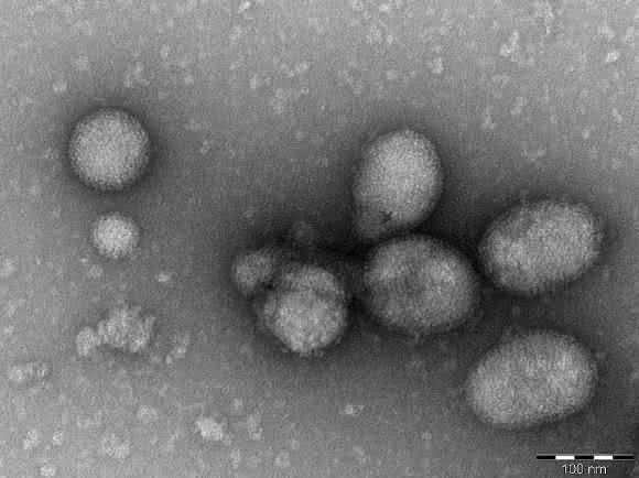 Ferak-Virus