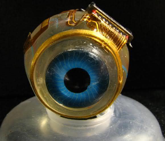 Retina-Implantat