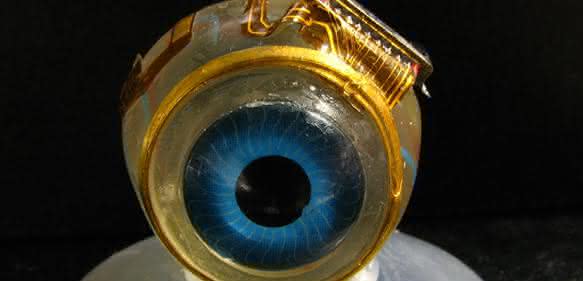 Retina-Implantat