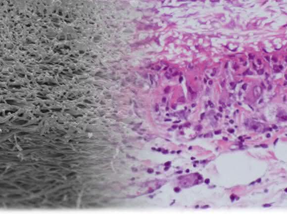 Biomaterial