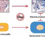 Zellschutzprogramm Seneszenz Zellschutzprogramm Seneszenz