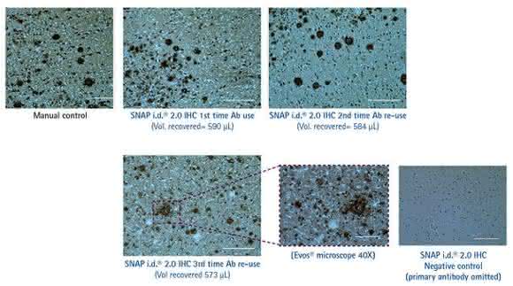 Anti-amyloid