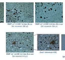 Anti-amyloid