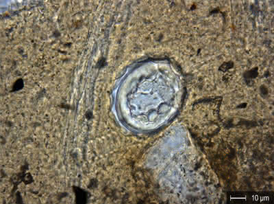 Geoarchäologie: Darmparasiteneier aus der Keltenzeit in Basel gefunden