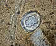 Geoarchäologie: Darmparasiteneier aus der Keltenzeit in Basel gefunden