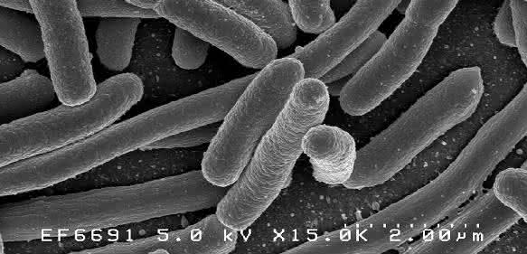 Escherichia Coli Escherichia Coli