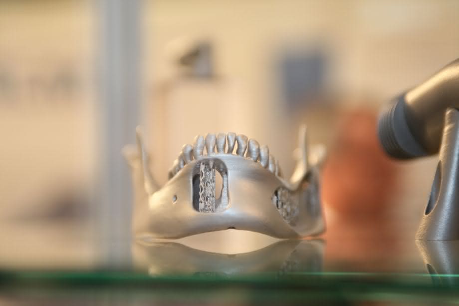 Prothese aus dem 3D-Drucker