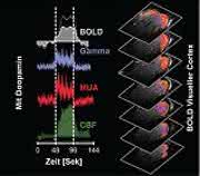 BOLD-Signal