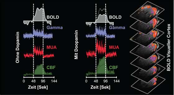 BOLD-Signal