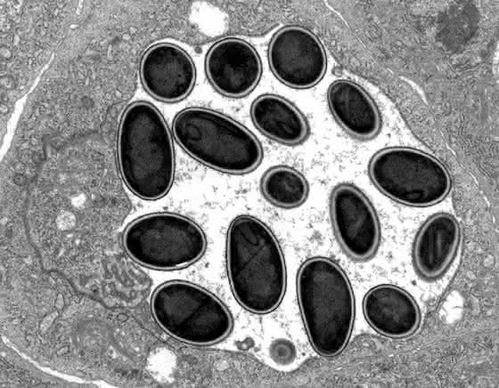 Zwischen Pilz und Parasit: Forscher erklären die Evolution extremer Parasiten