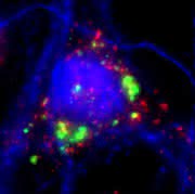 Multifunktionale Vesikel unterstützen Nervenzellen: Neuronen reagieren auf die Versorgungsleistung von Exosomen