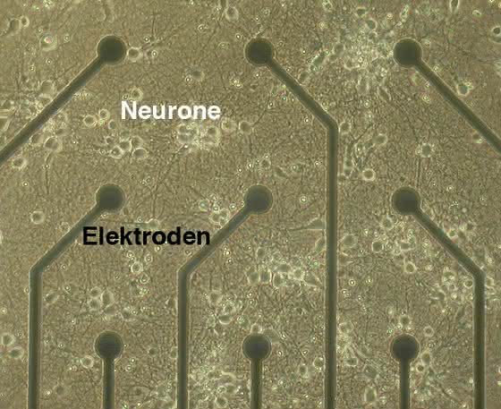 Multifunktionale Vesikel unterstützen Nervenzellen: Neuronen reagieren auf die Versorgungsleistung von Exosomen