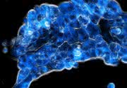 Krebstherapie: Strategie zur Reduktion von Nebenwirkungen