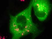 Kontrastmittel -Studie: Eisenoxid-Nanopartikel machen Wände von Blutgefäßen durchlässig Kontrastmittel -Studie: Eisenoxid-Nanopartikel machen Wände von Blutgefäßen durchlässig
