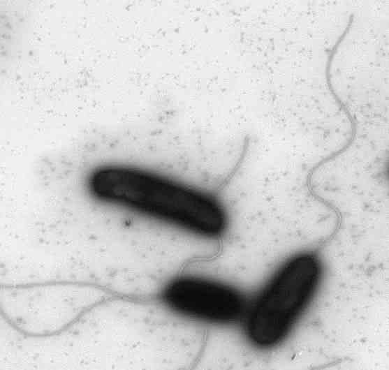 Cholera-Erreger