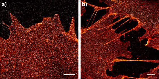 dSTORM-Mikroskopie: Nanokosmos der Zellen unter der Lupe