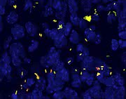 Antibiotikatolerante Bakterien: Langsam wachsende Keime erfordern lange Therapien Antibiotikatolerante Bakterien: Langsam wachsende Keime erfordern lange Therapien