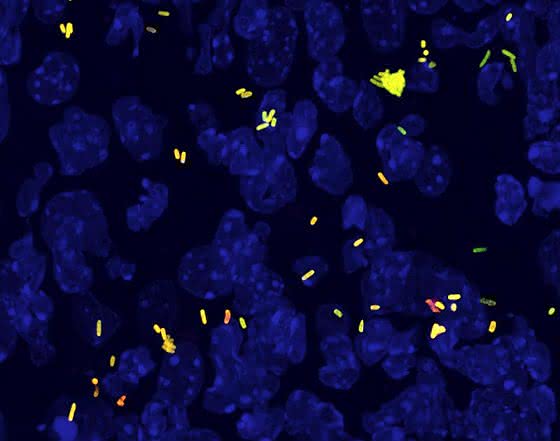 Antibiotikatolerante Bakterien: Langsam wachsende Keime erfordern lange Therapien