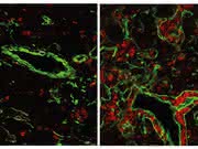 Reaktivierung eines sehr ursprünglichen Gens: Immunsystem um 500 Mio. Jahre zurückgedreht Reaktivierung eines sehr ursprünglichen Gens: Immunsystem um 500 Mio. Jahre zurückgedreht