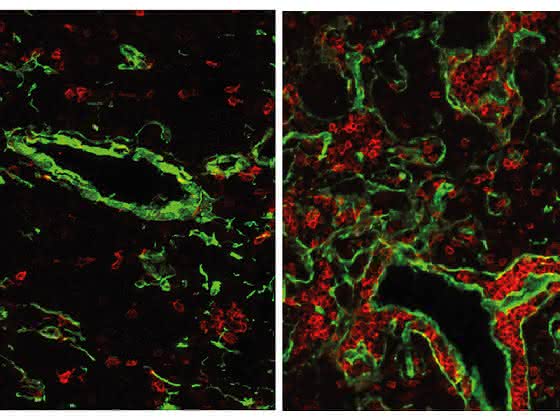Reaktivierung eines sehr ursprünglichen Gens: Immunsystem um 500 Mio. Jahre zurückgedreht Reaktivierung eines sehr ursprünglichen Gens: Immunsystem um 500 Mio. Jahre zurückgedreht