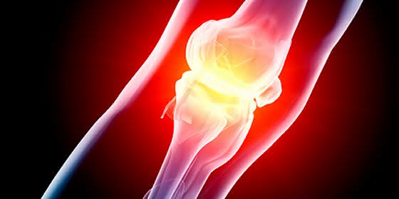 Pharmaforschung: Therapie gegen Arthritis