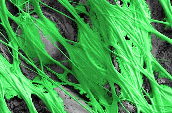 Spinnenfäden: Wie Spinnen ihre Netze verkleben Spinnenfäden: Wie Spinnen ihre Netze verkleben