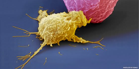Autoimmunerkrankungen: Tarnkappe für Immunzellen