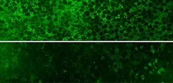 Übergewicht und Diabetes: HO-1 macht Dicke krank