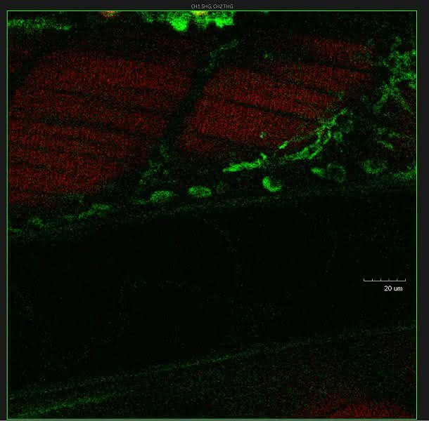 Neues Multiphotonensystem: In-vivo-Imaging erreicht neue Tiefen