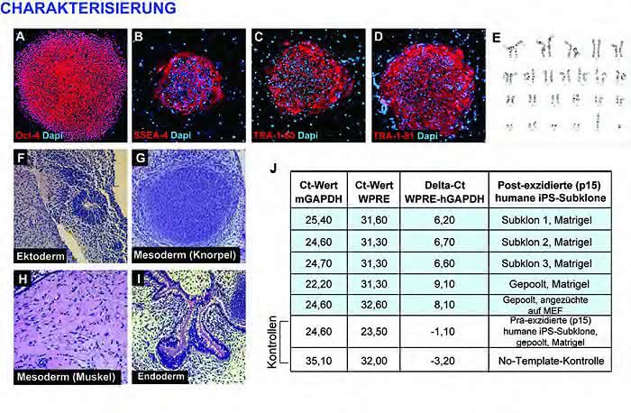 Exzision viraler Vektoren aus iPS-Zellen unter Verwendung von zellmembrangängigem TAT-Cre-Protein: Effiziente Gewinnung transgenfreier iPS-Zellen Exzision viraler Vektoren aus iPS-Zellen unter Verwendung von zellmembrangängigem TAT-Cre-Protein: Effiziente Gewinnung transgenfreier iPS-Zellen