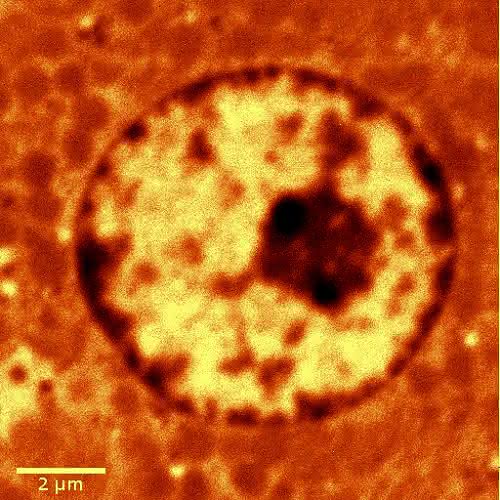 Piezo-Scantische: Kombination unterschiedlicher Mikroskopietechniken