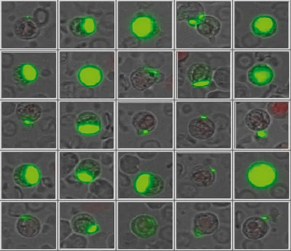 Tumorstammzellen: Die gefährlichsten Zellen eines Tumors diagnostisch nutzen