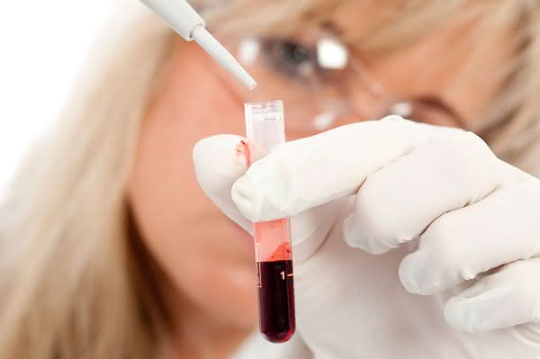 Prädiktive Blut-Biomarker: Krankheiten vermeiden, bevor sie entstehen