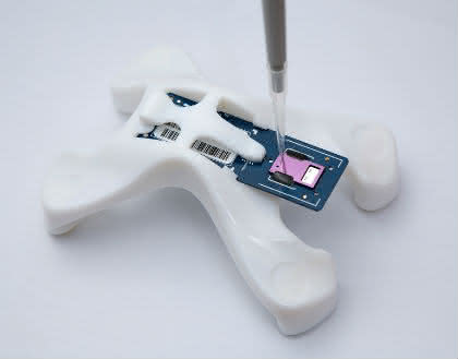 Life Sciences Innovations: Lab-on-Chip erkennt mehrere tropische Infektionskrankheiten Life Sciences Innovations: Lab-on-Chip erkennt mehrere tropische Infektionskrankheiten