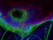 Hirnforscher aus Tübingen und Münster korrigieren DNA-Mutation an humanen Stammzellen: Parkinson im Reagenzglas
