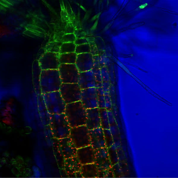 Live-Cell-Imaging: Visualisierung der molekularen Dynamik des Lebens