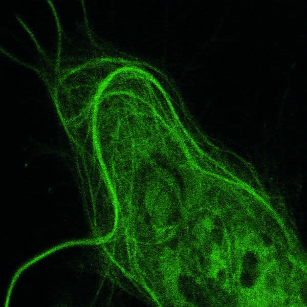 Live-Cell-Imaging: Visualisierung der molekularen Dynamik des Lebens