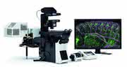 Laser-Scanning-Mikroskop: Lebendzellbeobachtung