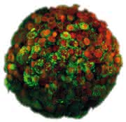 News: Zellen im Fokus der Uniklinik Jena: PELOBiotech referiert über 3D-Zellkultur